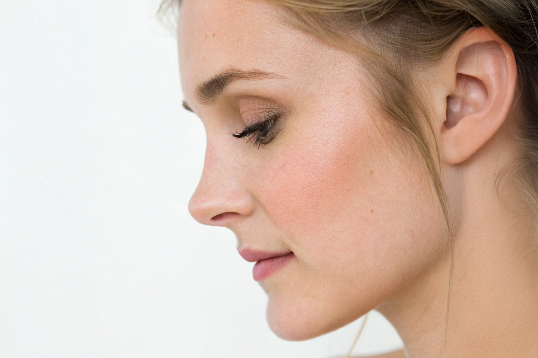 Rhinoplasty in Mexico City
